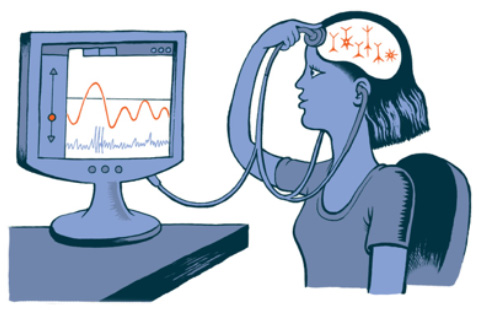 Neurotherapie